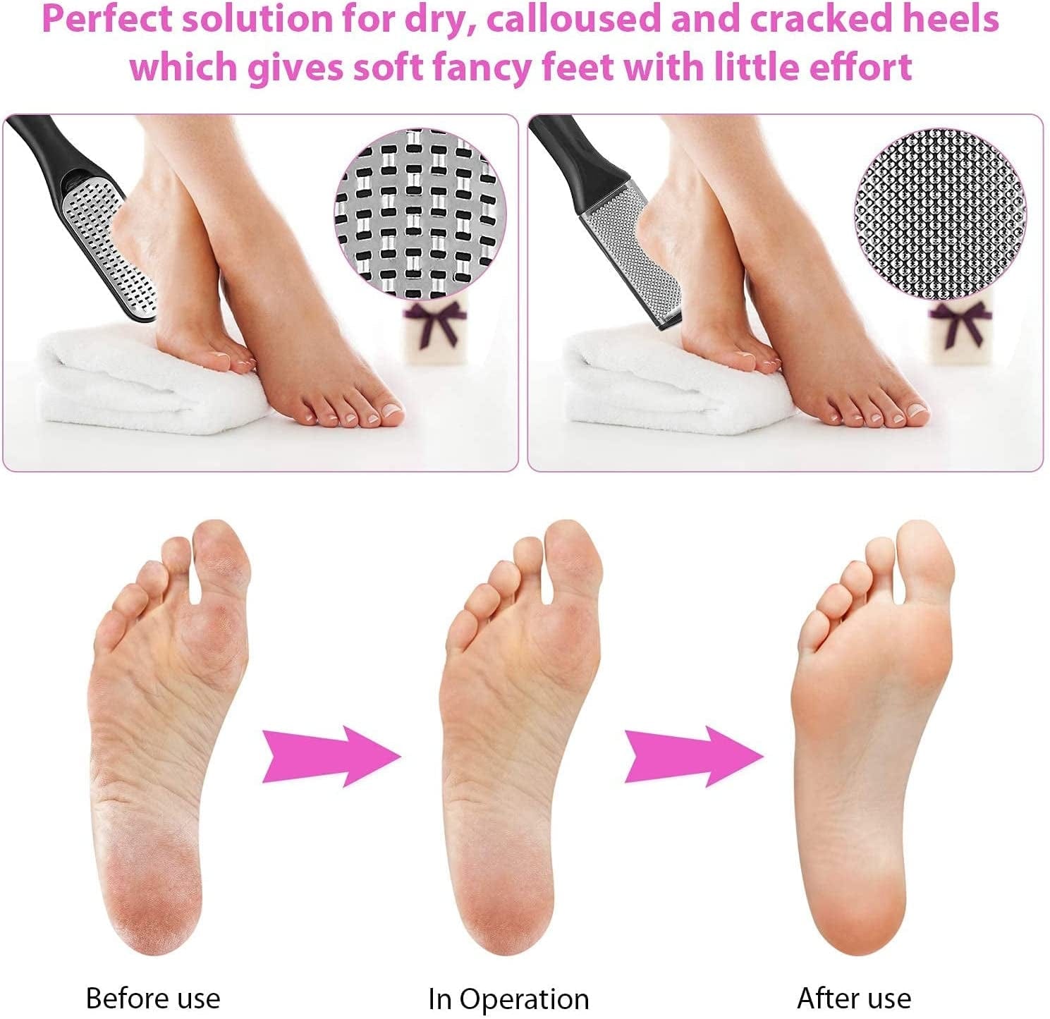 Adamstar 23 in 1 Professional Pedicure Kit for Men Women, Foot Care Pedicure Tools Set, Foot File Callus Remover, Toenail Clipper Foot Scrubber, Foot Rasp Dead Skin Foot Spa Kit at Home, Salon Health & Beauty > Personal Care > Foot Care AdamStar   