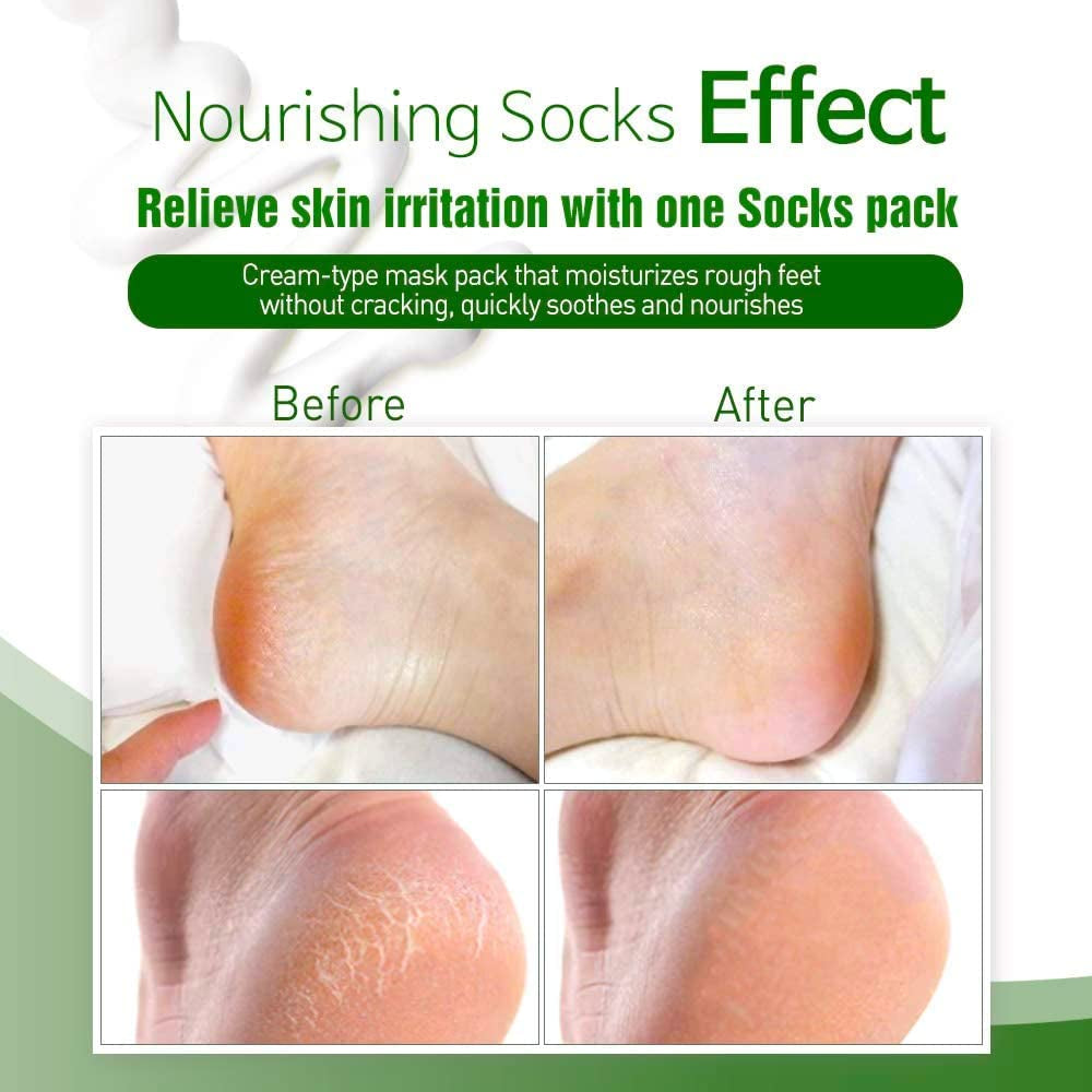 Epielle Nourishing Foot Masks - Hemp + Rosemary Extract for Deep Moisturizing 100% Vegan & Cruelty-Free (Socks 6Pk), Beauty Gifts | Skincare Gifts | Skincare Party Favors. Stocking Stuffers!! Health & Beauty > Personal Care > Foot Care Epielle   