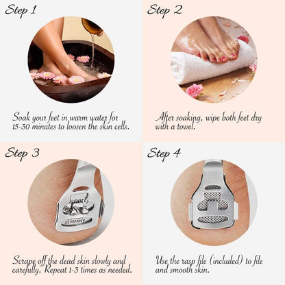 Allura Foot Care Pedicure Callus Shaver Cutter Rasp File Hard Skin Corn Remover Wood Handle 10 Blades (Case Included) Health & Beauty > Personal Care > Foot Care Allura   
