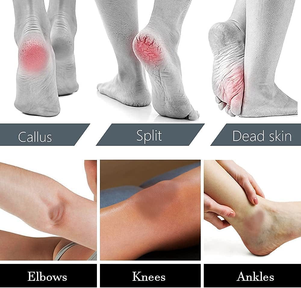 Amble Foot File, Nanomaterials Foot Rasp and Callus Remover - Professional Foot Care Pedicure Foot Scrubber Tool to Remove Cracked Heels, Mother'S Day Gift, Dead Skin, Hard Skin… Health & Beauty > Personal Care > Foot Care Amble   