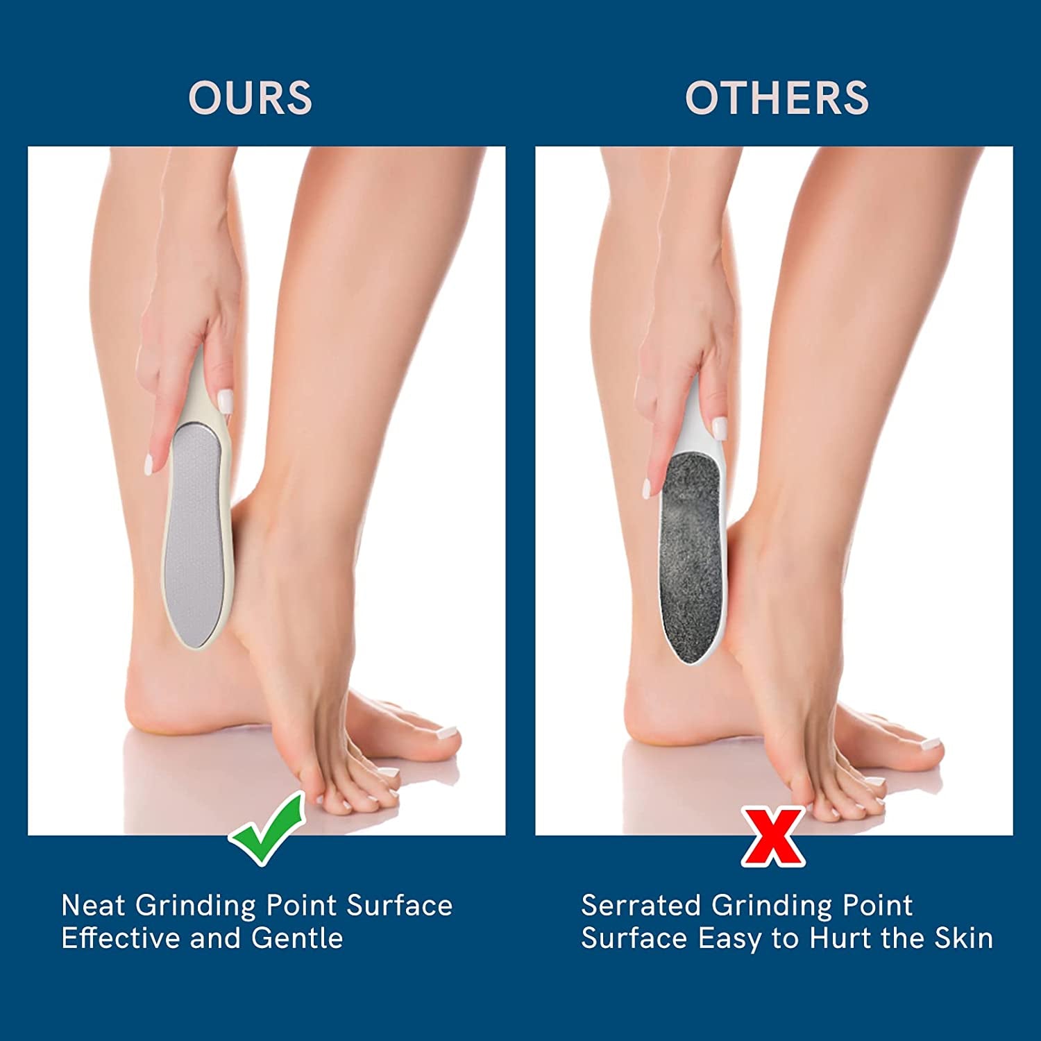 Foot Filer Dead Skin, Double Sided Foot Scraper Wet/ Dry Use, Foot Rasp for Cracked Heel and Foot Corn Removal, Portable Foot Care Tool, Pedicure File, Orange Health & Beauty > Personal Care > Foot Care Cut it   