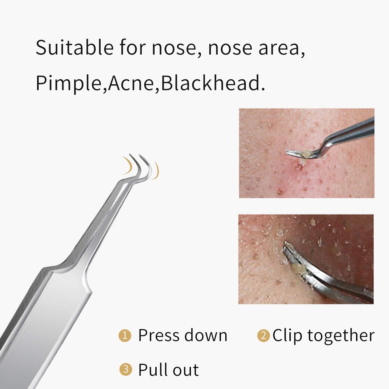 FIXBODY Blackhead and Splinter Remover Tools - Stainless Steel Professional Easily Cure Pimples Whiteheads Comedones Acne Zit Ingrown Hairs and Facial Impurities Bend Head Tweezer Surgical Kit Health & Beauty > Personal Care > Cosmetics > Cosmetic Tools > Skin Care Tools FIXBODY   