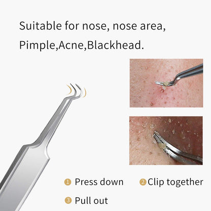 FIXBODY Blackhead and Splinter Remover Tools - Stainless Steel Professional Easily Cure Pimples Whiteheads Comedones Acne Zit Ingrown Hairs and Facial Impurities Bend Head Tweezer Surgical Kit Health & Beauty > Personal Care > Cosmetics > Cosmetic Tools > Skin Care Tools FIXBODY   