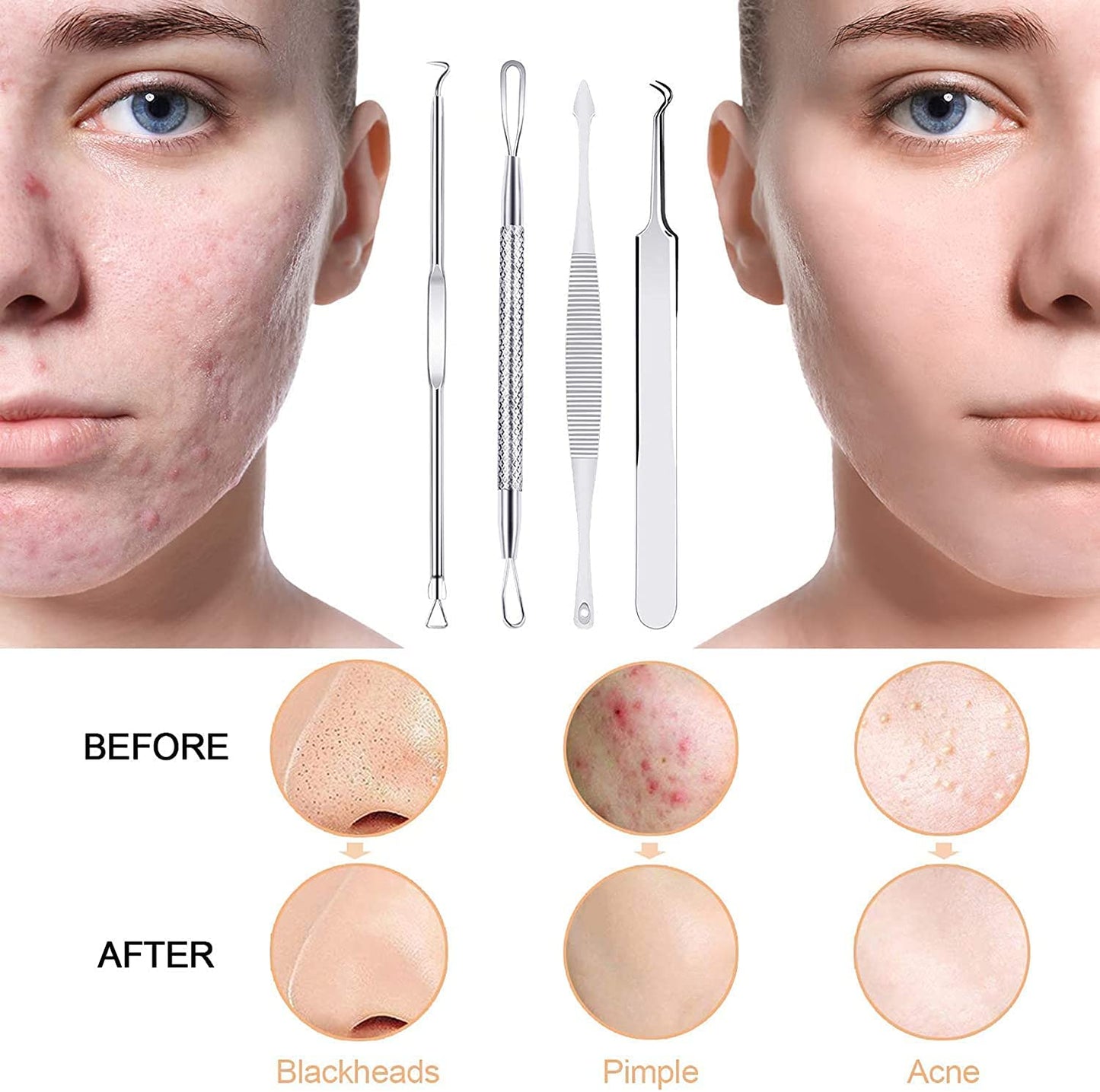Black Head Remover Pimple Popper Tool Kit 10 Pcs, Comedone Pimple Extractor Tool, Acne Kit for Blackhead, Whitehead Popping, Zit Removing(Silver) Health & Beauty > Personal Care > Cosmetics > Cosmetic Tools > Skin Care Tools MENOLY   