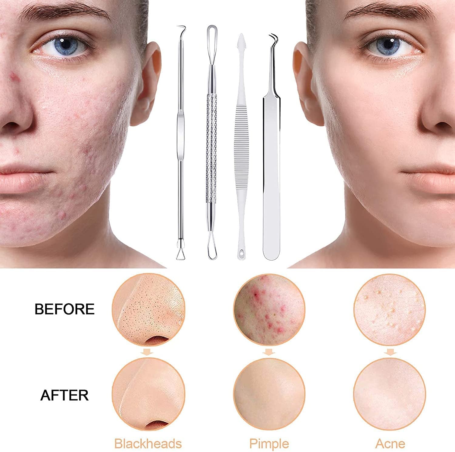 Black Head Remover Pimple Popper Tool Kit 10 Pcs, Comedone Pimple Extractor Tool, Acne Kit for Blackhead, Whitehead Popping, Zit Removing(Silver) Health & Beauty > Personal Care > Cosmetics > Cosmetic Tools > Skin Care Tools MENOLY   