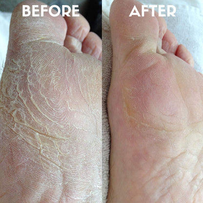 Legendary Apothecary Organic Oil - Organic Oil for Smooth Feet - USDA Certified Organic Oil for Dry Feet, Cracked Heels, Corns - 1 Fl.Oz Health & Beauty > Personal Care > Foot Care Legendary Apothecary   