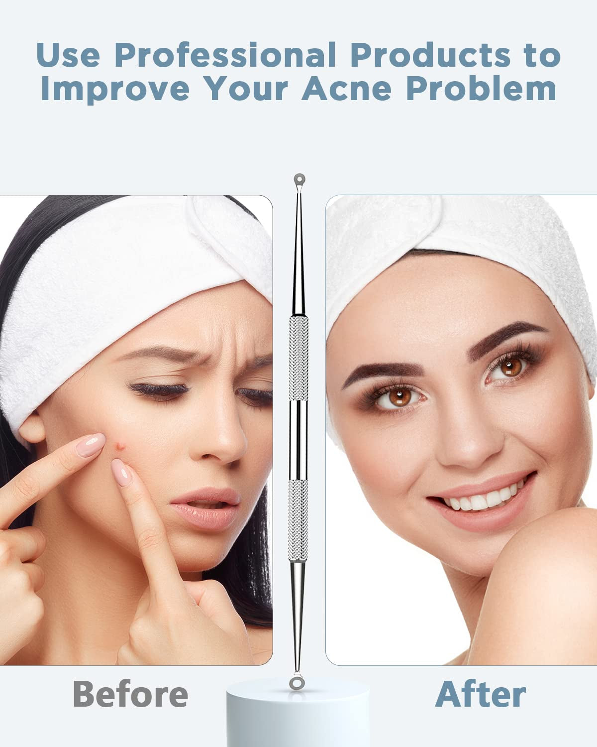 TAYTHI Blackhead Remover Tool, Pimple Popper Tool Kit, Blackhead Extractor Tool for Face, Extractor Tool for Comedone Zit Acne Whitehead Blemish, Stainless Steel Extraction Tools Health & Beauty > Personal Care > Cosmetics > Cosmetic Tools > Skin Care Tools TAYTHI   