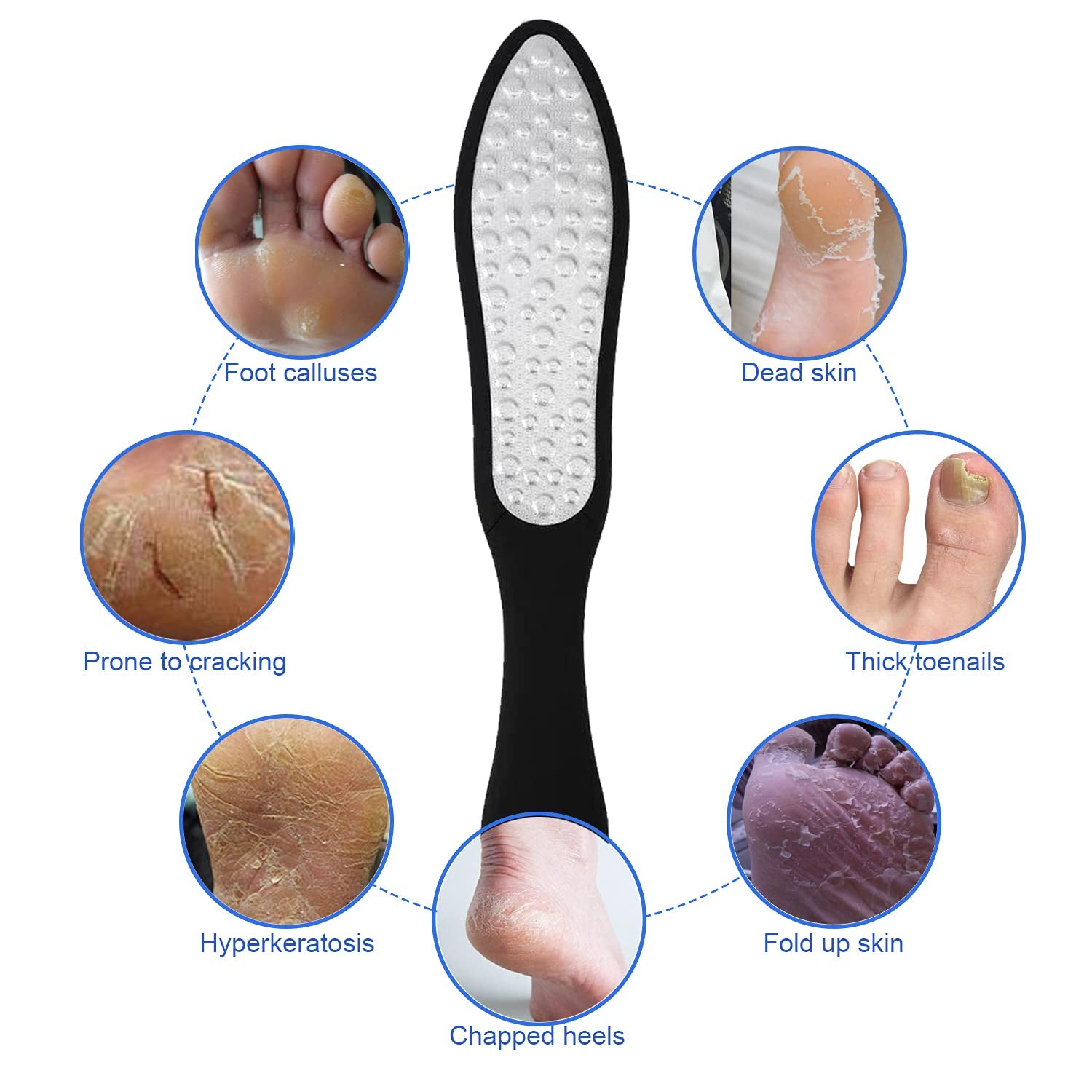 Foot Rasp Foot Files Callus Remover - Professional Foot Care Pedicure Stainless Steel File to Removes Hard Skin(Double-Sided Pointed) Health & Beauty > Personal Care > Foot Care Fanzbike   