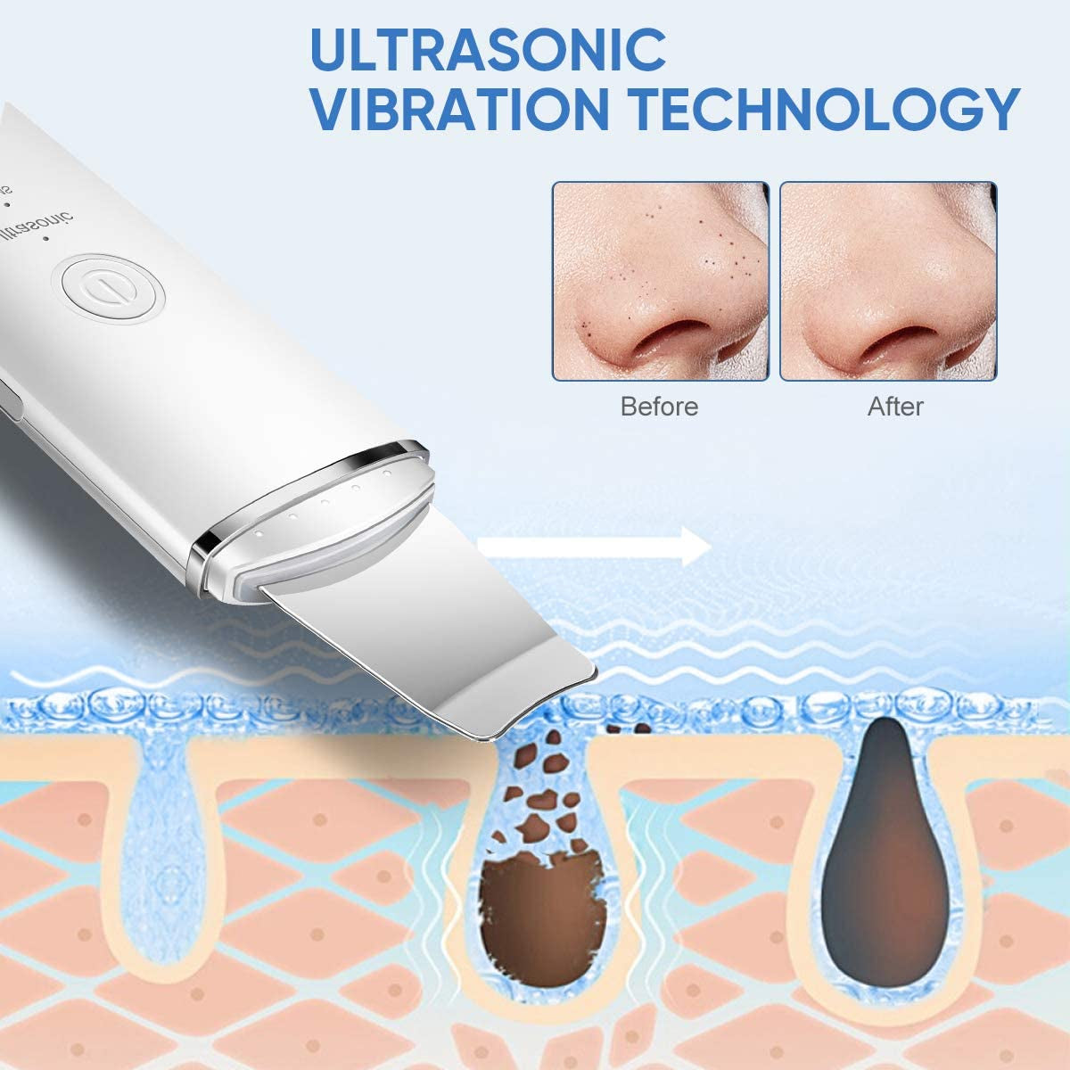 Ruoxu Skin Scrubber Face Spatula, Professional Skin Spatula Blackhead Remover with 4 Modes, Facial Pore Deep Cleansing Skin Care Tool for Women & Men, White Health & Beauty > Personal Care > Cosmetics > Cosmetic Tools > Skin Care Tools Ruoxu   
