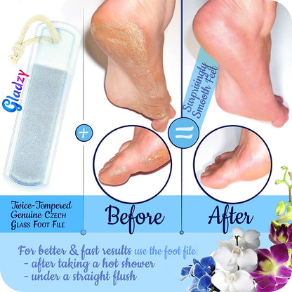 Genuine Czech Glass Nail File Set - Two-Sided Different Grit Surface, Callus Remover Foot Rasp, Manicure & Pedicure, Professional Nail Care, Wet & Dry Use, Cotton Towel, EU Quality (Green Aqua) Health & Beauty > Personal Care > Foot Care Gladzy   
