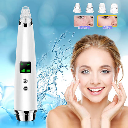 Handsomeface Blackhead Remover, Remover Vacuum Pore Cleaner Electric Suction, Facial Device Acne Comedone Extractor Tool USB with Hot Compress 5 Probes for Nose Face Women Health & Beauty > Personal Care > Cosmetics > Cosmetic Tools > Skin Care Tools Handsomeface   