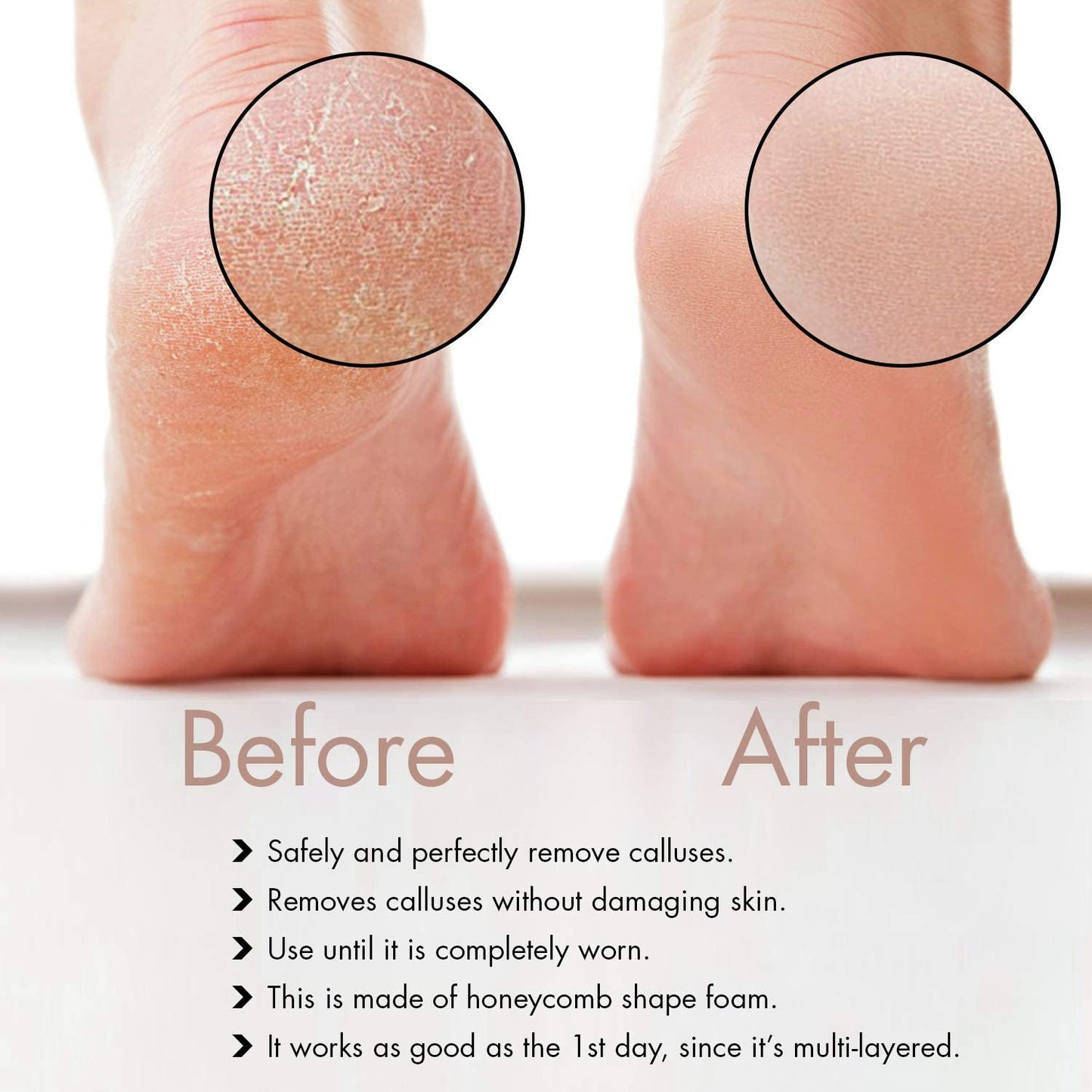 Professional Pedicure Foot File, Foot File Rasp, Callus Remover, Foot Scrubber - Perfect Foot Care for Cracked Heels - Corn Remover/File - Pedicure Tools, Heel Scraper File Health & Beauty > Personal Care > Foot Care Distributed by Miliamp   