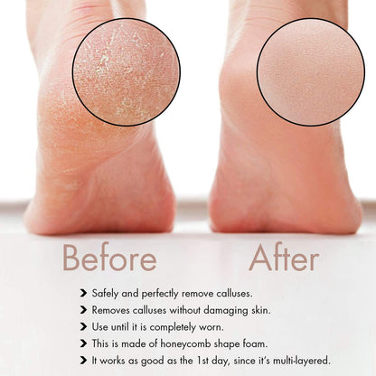 Professional Pedicure Foot File, Foot File Rasp, Callus Remover, Foot Scrubber - Perfect Foot Care for Cracked Heels - Corn Remover/File - Pedicure Tools, Heel Scraper File Health & Beauty > Personal Care > Foot Care Distributed by Miliamp   