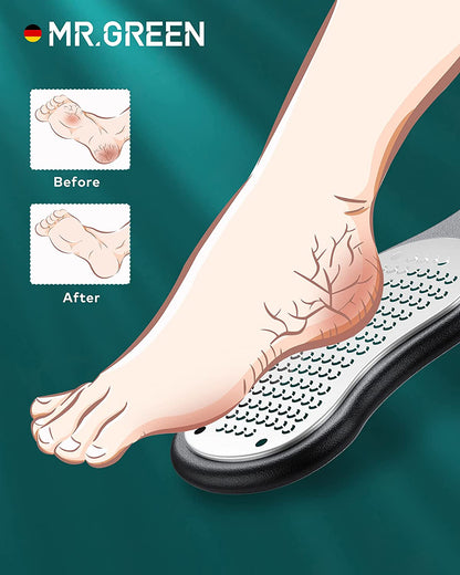 MR.GREEN Foot Rasp Foot File and Callus Remover Foot Care Pedicure Metal Surface Tool to Remove Hard Skin, Surgical Grade Stainless Steel File (Black) Health & Beauty > Personal Care > Foot Care MR.GREEN   