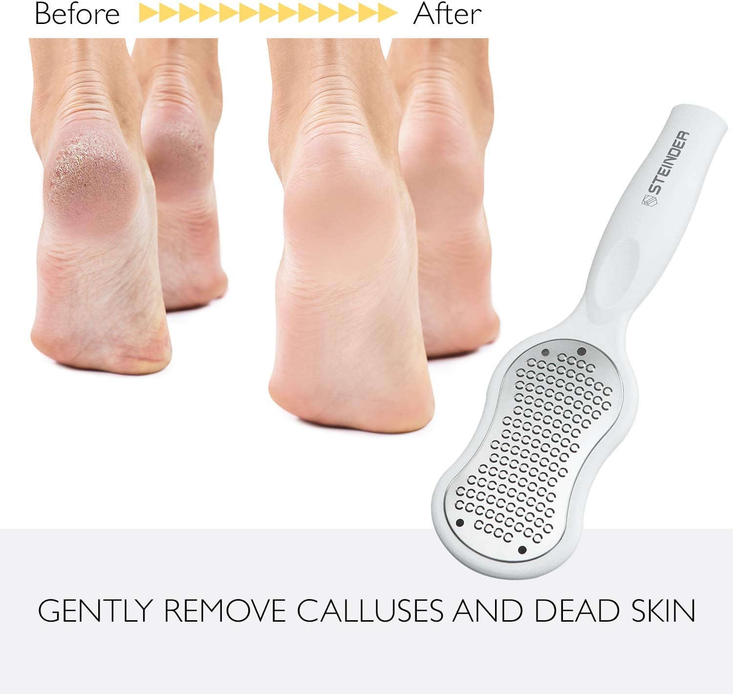 Foot Rasp Foot File and Callus Remover, 234 Foot Care Pedicure Metal Surface Tool, Korean-Made Precise Foot File, Foot File Callus Remover, Foot Scrubber, Foot Grater Health & Beauty > Personal Care > Foot Care STEINDER   