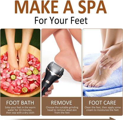 Electric Foot Callus Remover Kit, Banral 10 In1 Rechargeable Pedicure Tools Foot Care Feet File with 3 Roller Heads,2 Speed,Battery Display for Remove Cracked Heels Calluses and Dead Skin Health & Beauty > Personal Care > Foot Care Banral   