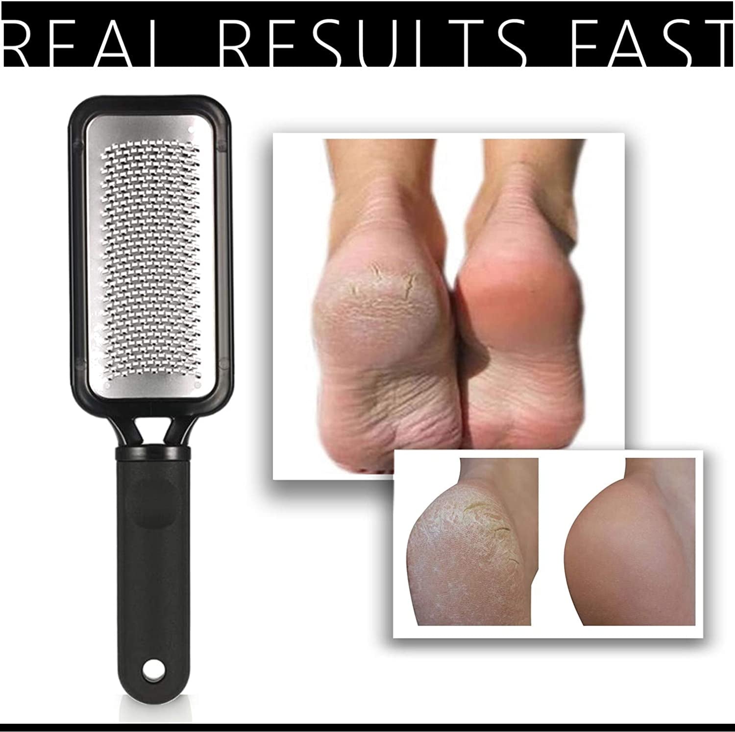 Elavae Large Foot Rasp Callus Remover for Feet. Foot Care File for Cracked Heel Treatment. Replace Foot Scrubber, Scraper or Foot Peel. Quality Pedicure Tool to Remove Dead Skin. Professional Results Health & Beauty > Personal Care > Foot Care ELAVAE   