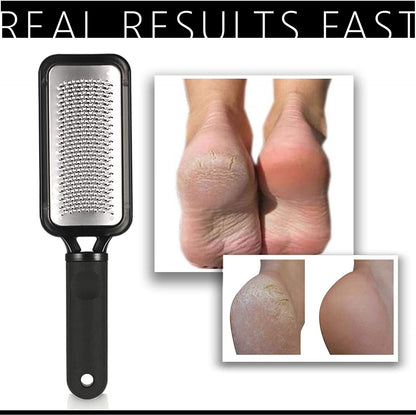 Elavae Large Foot Rasp Callus Remover for Feet. Foot Care File for Cracked Heel Treatment. Replace Foot Scrubber, Scraper or Foot Peel. Quality Pedicure Tool to Remove Dead Skin. Professional Results Health & Beauty > Personal Care > Foot Care ELAVAE   
