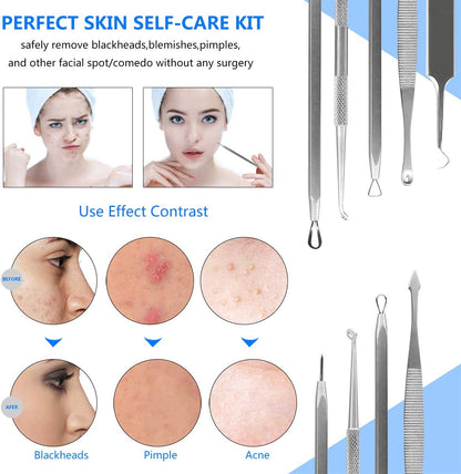 Vamotto Pimple Popper Tool Kit -10 Pcs Blackhead Remover Comedone Extractor Kit Blemish Remover for Acne Removal Kit for Whitehead Popping Zit Removing for Nose Face Tools with a Leather Bag Health & Beauty > Personal Care > Cosmetics > Cosmetic Tools > Skin Care Tools Boolink   