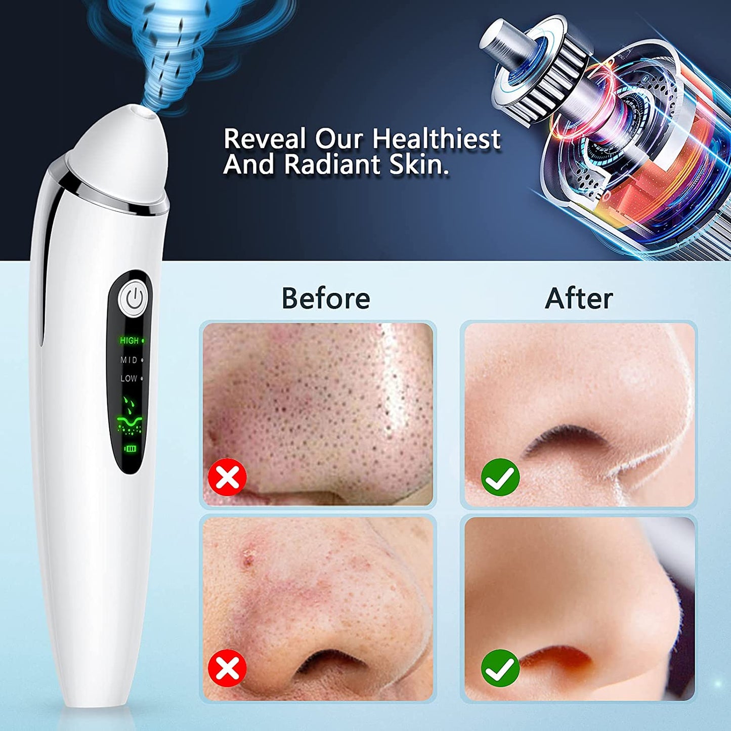 Blackhead Remover Pore Vacuum, Electric Facial Deep Cleaner, USB Rechargeable Male and Female Acne Whitehead Extraction Tool, 6 Suction Heads & 3 Adjustable Suction Health & Beauty > Personal Care > Cosmetics > Cosmetic Tools > Skin Care Tools TTozka   