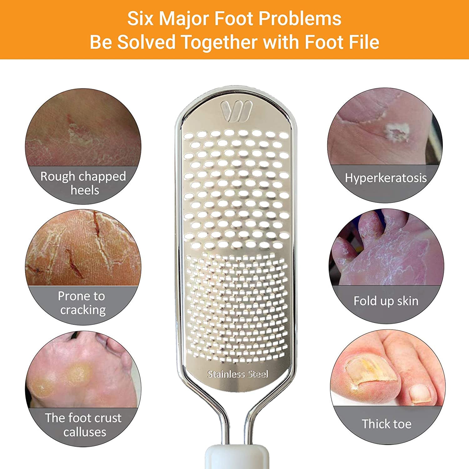 Colossal Foot Rasp Foot File and Callus Remover, Best Foot Care Pedicure Metal Surface Tool to Remove Hard Skin, Can Be Used on Both Wet and Dry Feet, Surgical Grade Stainless Steel File Health & Beauty > Personal Care > Foot Care Whiteh   