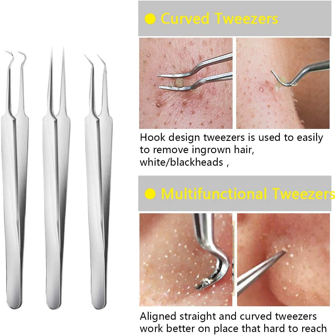 Pimple Popper Tool Kit Blackhead Tweezer, Aooeou Acne Removal Comedone Extractor Kit Pimple Tweezers for Pimples, Blackheads, Blemish, Whitehead, Zit Removing for Forehead Nose Facial Pore Health & Beauty > Personal Care > Cosmetics > Cosmetic Tools > Skin Care Tools Aooeou   