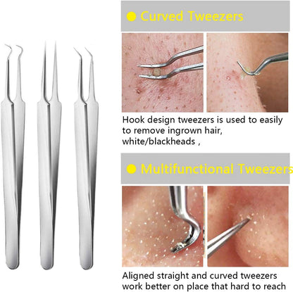 Pimple Popper Tool Kit Blackhead Tweezer, Aooeou Acne Removal Comedone Extractor Kit Pimple Tweezers for Pimples, Blackheads, Blemish, Whitehead, Zit Removing for Forehead Nose Facial Pore Health & Beauty > Personal Care > Cosmetics > Cosmetic Tools > Skin Care Tools Aooeou   