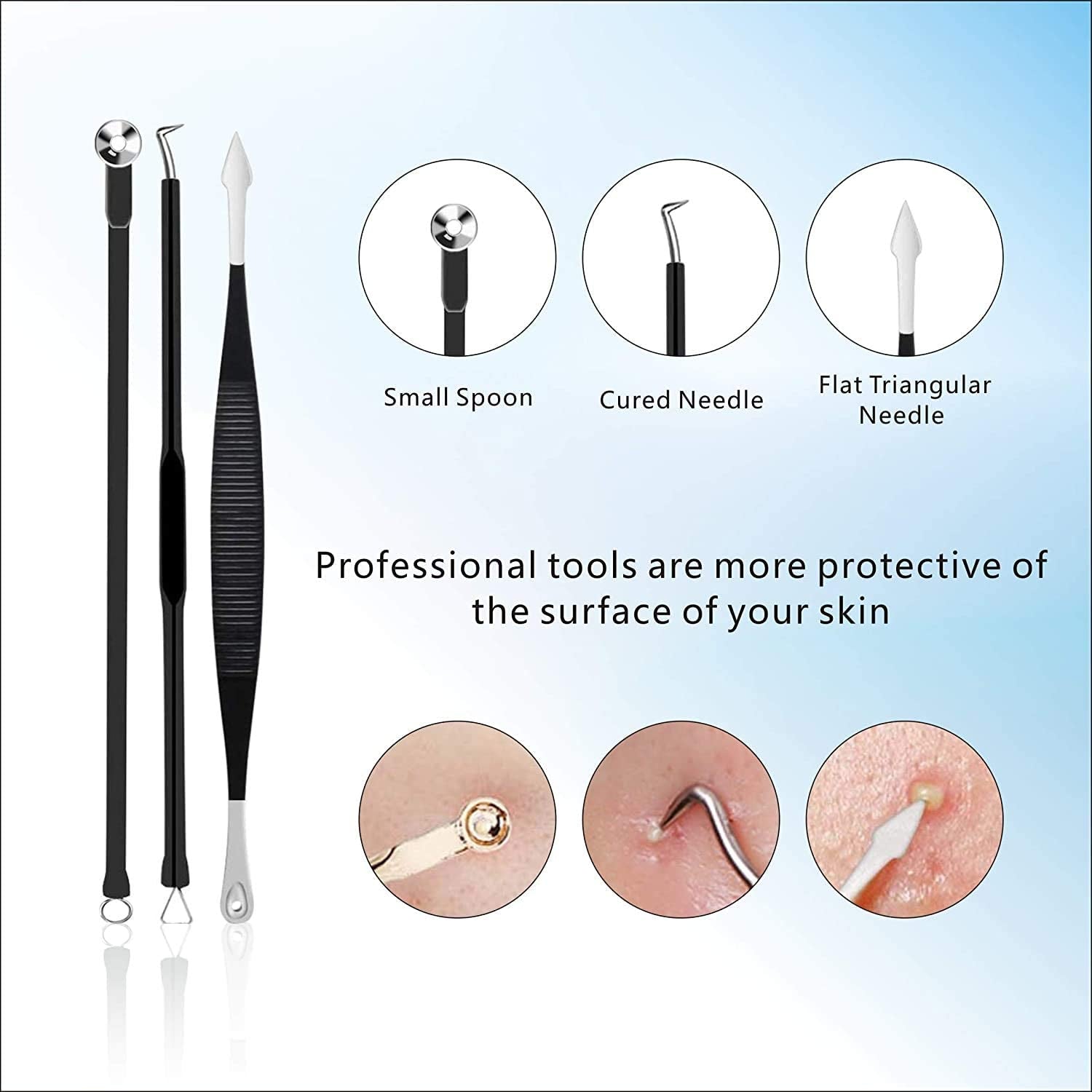 Pimple Popper Tool Kit 11 Pcs, Ybaoo Blackhead Remover Pimple Extractor Tools with Metal Case for Quick and Easy Removal of Blackheads,Pimples,Whiteheads,Zit Popper,Forehead,Facial and Nose (Black) Health & Beauty > Personal Care > Cosmetics > Cosmetic Tools > Skin Care Tools Ybaoo   