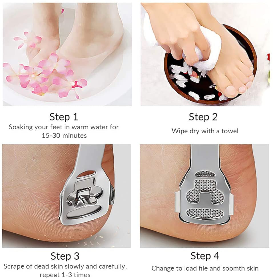 Codream Pedicure Callus Shaver Foot File Care Hard Skin Remover Callus Shaver Sets with Case, Foot File Heads & 10 Replacement Blade Health & Beauty > Personal Care > Foot Care Codream   