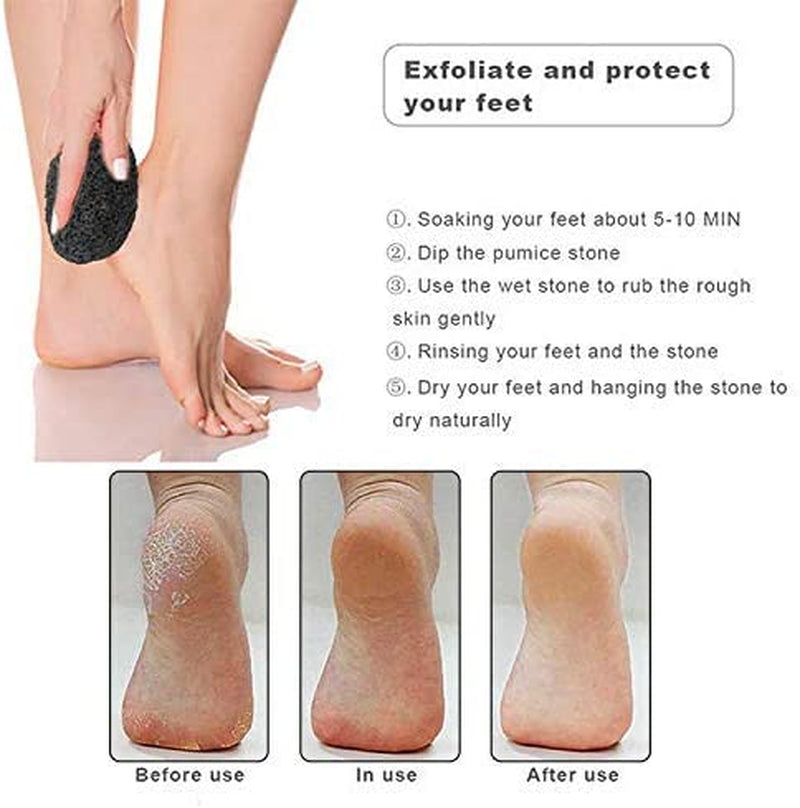 Vridale Pumice Stones for Feet Lava Pumice Stone Foot File Callus Removal Foot Scrubber for Hands Care Foot Exfoliation Dead Skin Remover with Handle Health & Beauty > Personal Care > Foot Care Vridale   
