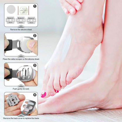 Manords 20 in 1 Professional Pedicure Kit, Pedicure Tools Set Foot Scrubber Dead Skin Remover Foot Care Kit for Women Men Salon or Home 33 Health & Beauty > Personal Care > Foot Care Manords   