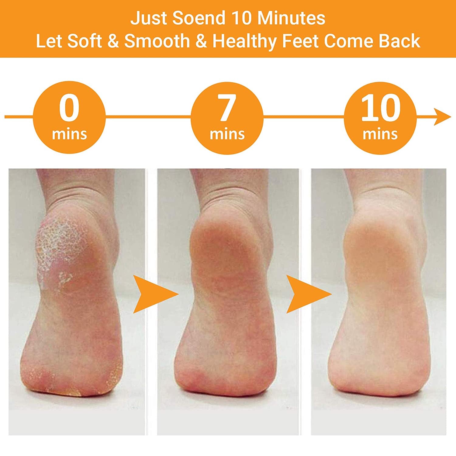 Colossal Foot Rasp Foot File and Callus Remover, Best Foot Care Pedicure Metal Surface Tool to Remove Hard Skin, Can Be Used on Both Wet and Dry Feet, Surgical Grade Stainless Steel File Health & Beauty > Personal Care > Foot Care Whiteh   