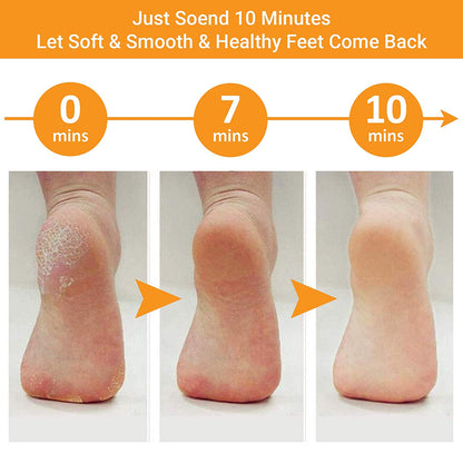 Colossal Foot Rasp Foot File and Callus Remover, Best Foot Care Pedicure Metal Surface Tool to Remove Hard Skin, Can Be Used on Both Wet and Dry Feet, Surgical Grade Stainless Steel File Health & Beauty > Personal Care > Foot Care Whiteh   