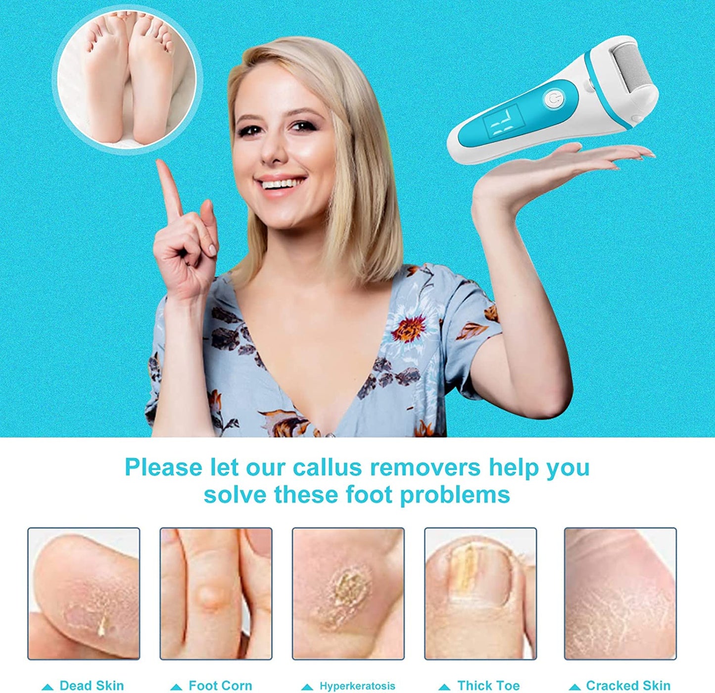 Electric Callus Removers for Feet,Rechargeable Pedicure Tools Foot Care Feet File,Professional Waterproof 13 in 1 Callous Remover Kit,With 3 Roller Heads 2 Speed,Battery Display Health & Beauty > Personal Care > Foot Care YOIDOO   