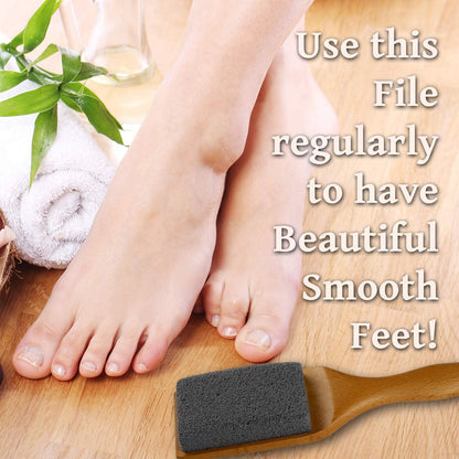 Professional Pedicure Foot File, Foot File Rasp, Callus Remover, Foot Scrubber - Perfect Foot Care for Cracked Heels - Corn Remover/File - Pedicure Tools, Heel Scraper File Health & Beauty > Personal Care > Foot Care Distributed by Miliamp   