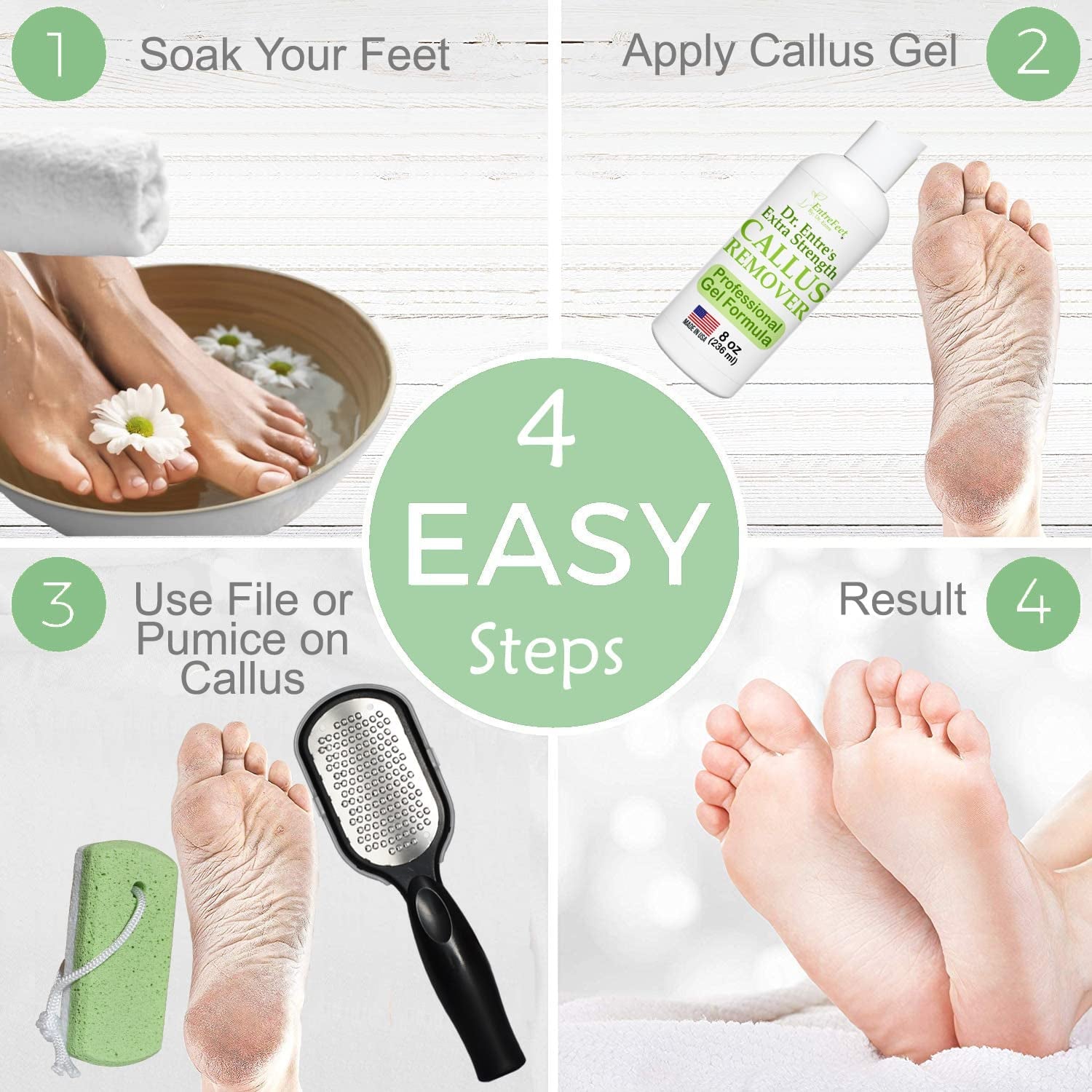 Dr. Entre'S Callus Remover Kit for Feet: 8Oz Callus Remover Gel, Foot File, Pumice Stone, 5 Glove Pairs for Gel Application, Spa Kit, Foot Care, Pedicure Tools, Scrubber Health & Beauty > Personal Care > Foot Care EntreFeet   