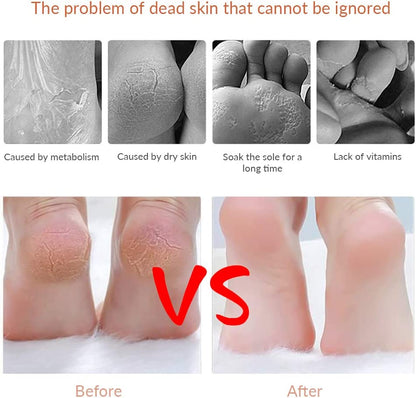 Codream Pedicure Callus Shaver Foot File Care Hard Skin Remover Callus Shaver Sets with Case, Foot File Heads & 10 Replacement Blade Health & Beauty > Personal Care > Foot Care Codream   