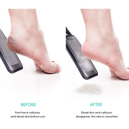 Feet Scrubber Dead Skin 5 Pack - KENED Foot File Callus Remover for Feet, Professional Pedicure Kit with 2 X Metal Foot Grater, 3 X White Double-Sided Pedicure Tools for Feet Care Health & Beauty > Personal Care > Foot Care KENED   