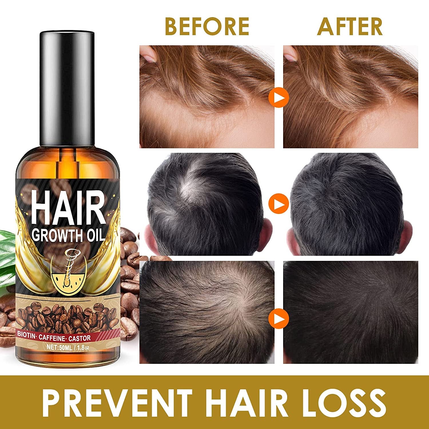 Hair Growth Oil with Biotin, Castor, and Caffeine - 99% Natural Hair Care Serum for Stronger, Thicker, Prevent Hair Loss, Promotes Hair Regrowth, Repairs Hair Follicles, Rid of Itchy and Dry Scalp, Stress Relief & Headaches-50Ml Health & Beauty > Personal Care > Hair Care CENNYO   