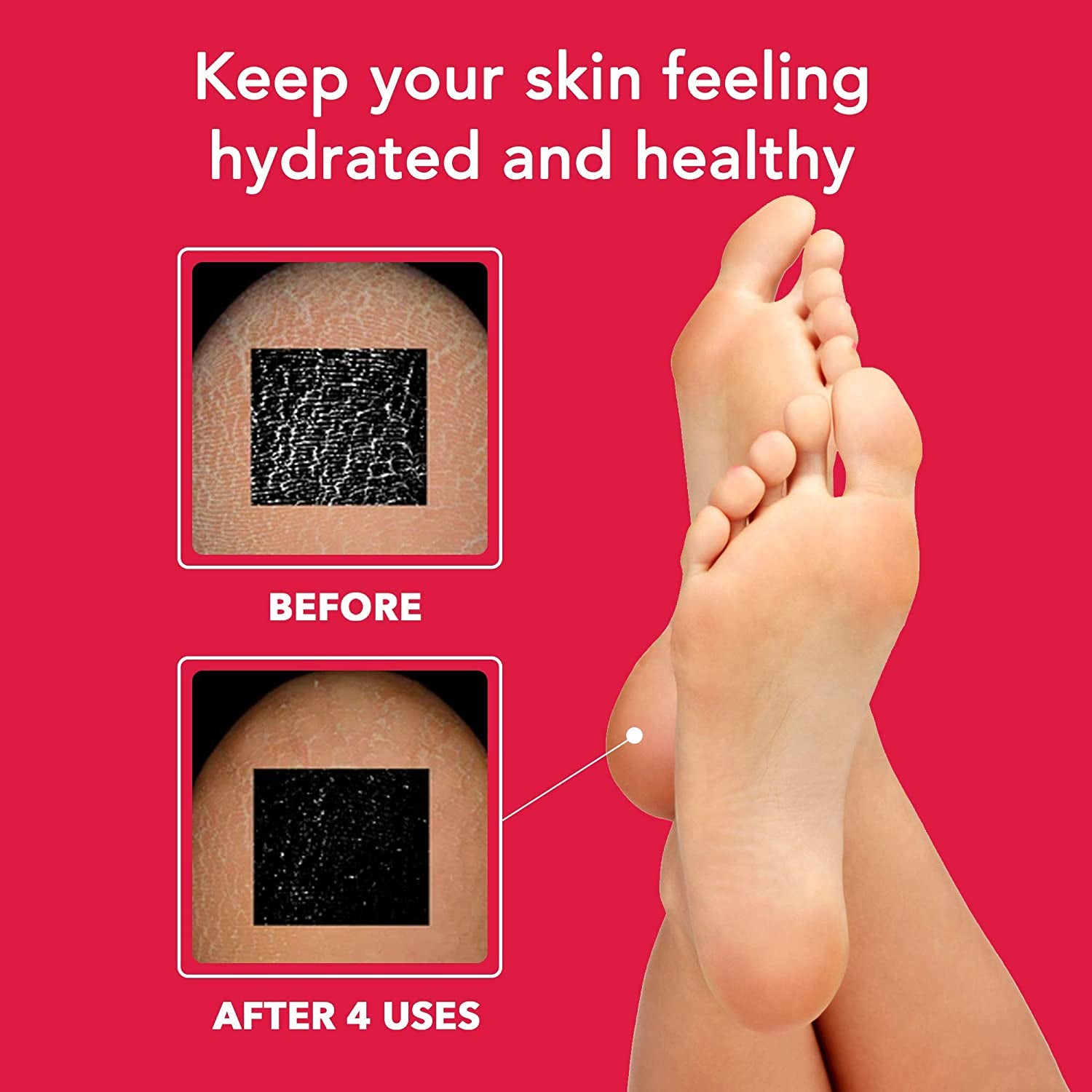 Peony Foot Mask, Feet Masks for Dry Skin, Foot Mask for Dry Cracked Feet, Dry Feet Treatment, Cracked Feet Treatment, Moisturizing Foot Mask - Soon Skincare Health & Beauty > Personal Care > Foot Care KYLIE MAX   