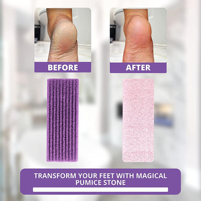 Love Natural Pumice Stone for Feet - Ultimate 2-In-1 Scrubber and Professional Exfoliating Rock for Feet Hands Body Care - Pumice Stone for Dead Skin & Callus Removal (Purple) Health & Beauty > Personal Care > Foot Care LOVE PUMICE   
