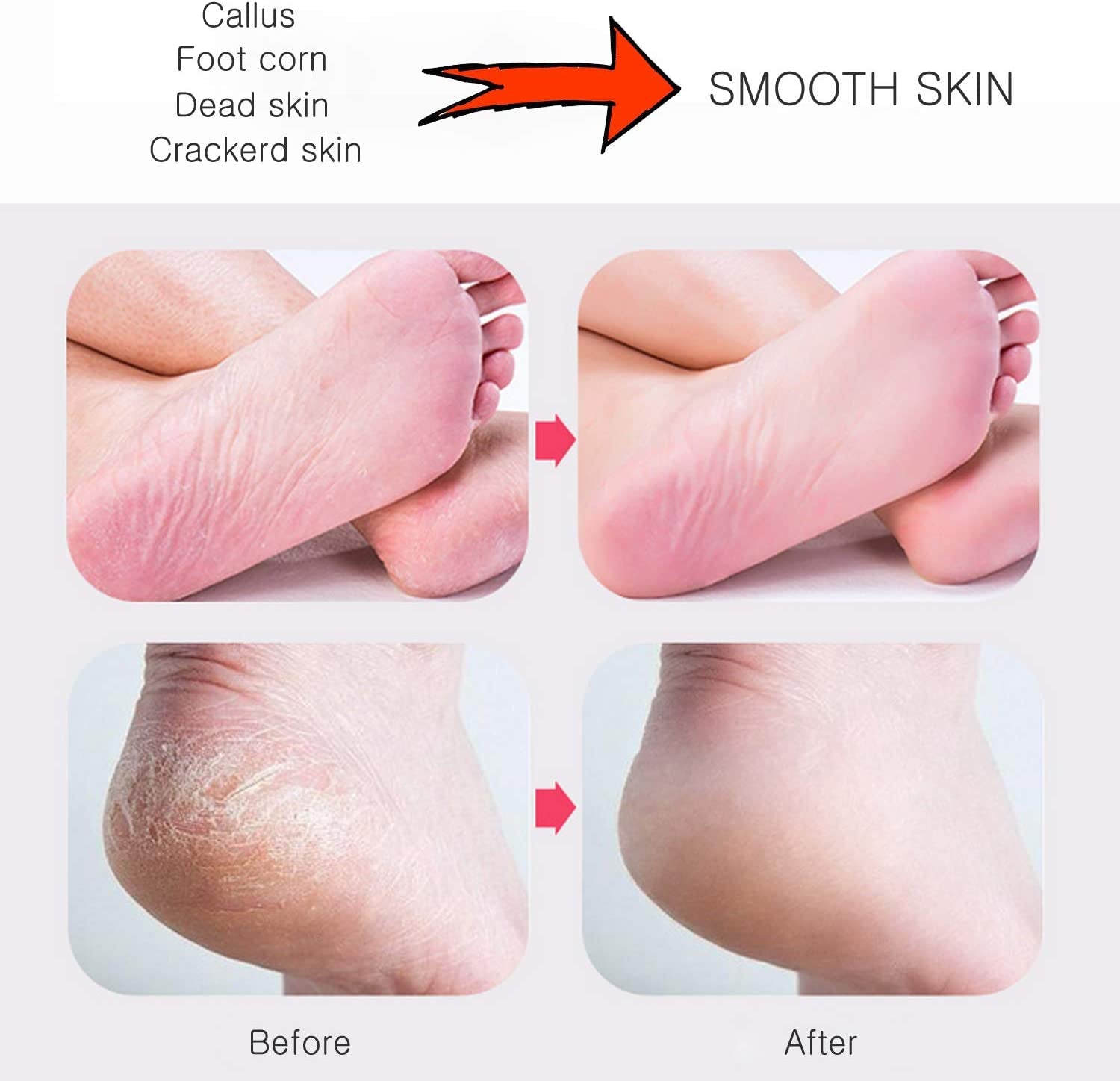Foot File Colossal Foot Rasp and Callus Remover, Professional Foot Care Pedicure Metal Surface Tool to Remove Hard Skin, Can Be Used on Both Wet and Dry Feet, Surgical Grade Stainless Steel File Health & Beauty > Personal Care > Foot Care LUDOUPIER   