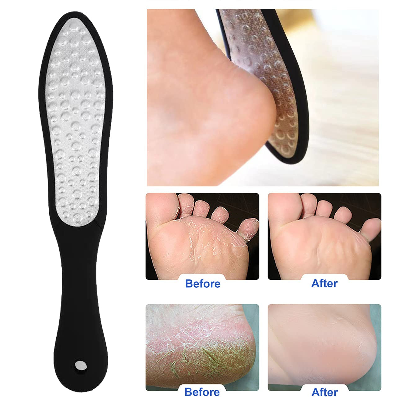 Foot Rasp Foot Files Callus Remover - Professional Foot Care Pedicure Stainless Steel File to Removes Hard Skin(Double-Sided Pointed) Health & Beauty > Personal Care > Foot Care Fanzbike   