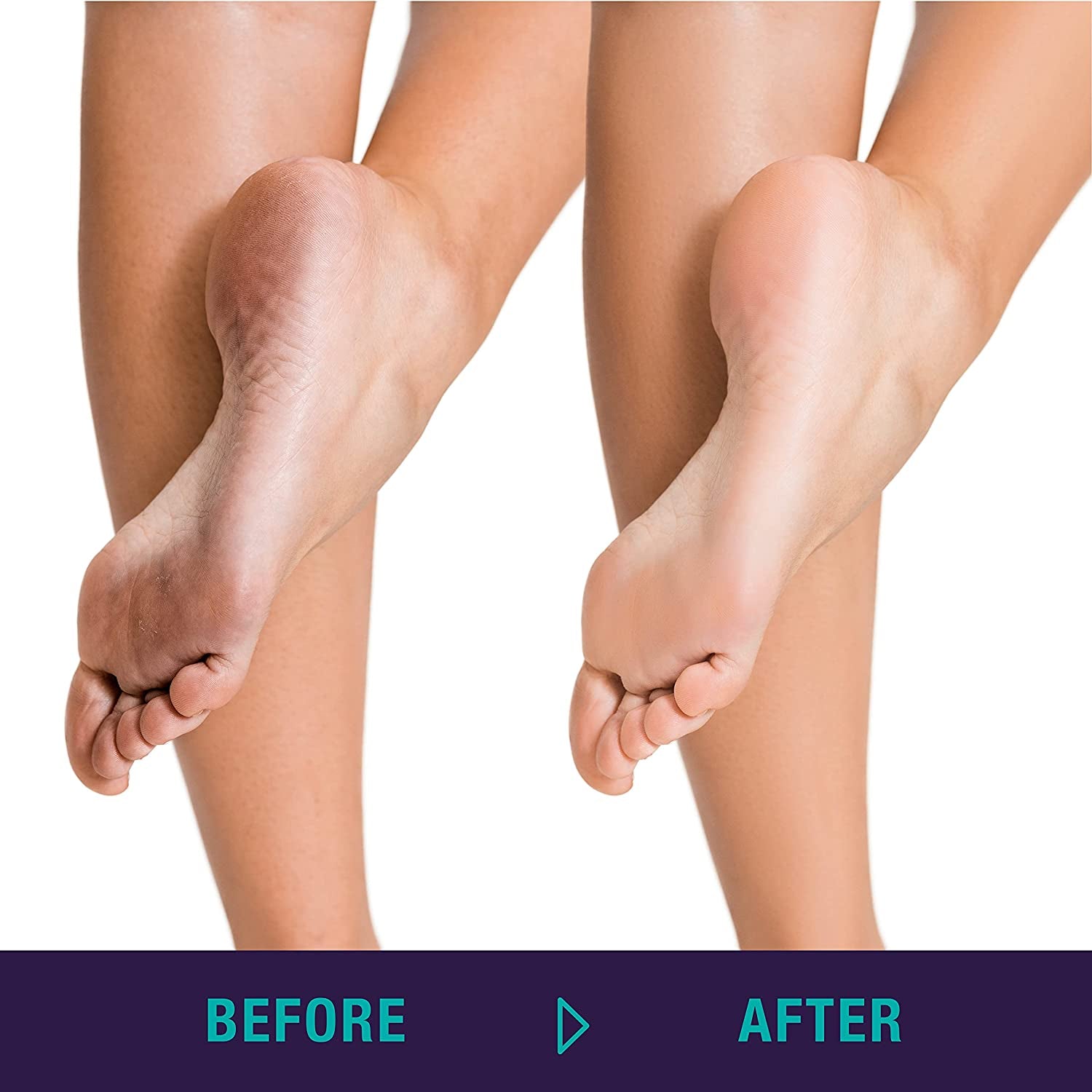 TRIM Simply Foot 4-In-1 Foot Paddle – Include Metal Foot Rasp, Pumice Stone, Foot Brush, and Abrasive Surface – Easy to Use Foot Care Tools for DIY Pedicures – Ideal for Men and Women – Teal Health & Beauty > Personal Care > Foot Care Trim   