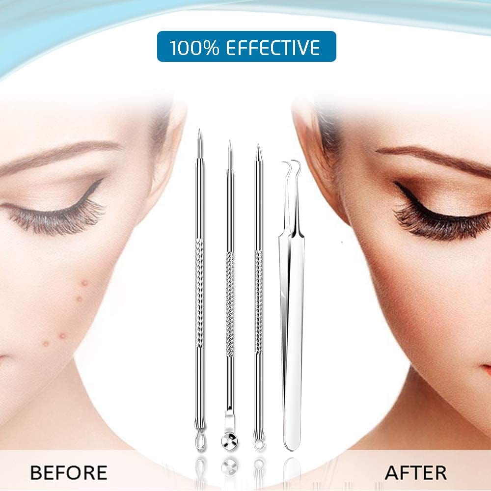 [Upgraded] 8PCS Blackhead Remover, Pimple Tool Kit, Acne Tools, Comedone Extractor, Blemish Whitehead Removal, Professional Curved Tweezers Kits, Premium Stainless Steel Health & Beauty > Personal Care > Cosmetics > Cosmetic Tools > Skin Care Tools Mroobest   