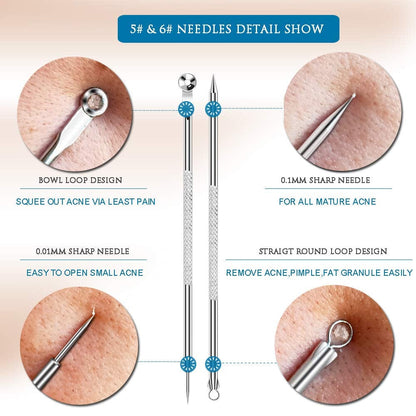 [Upgraded] 8PCS Blackhead Remover, Pimple Tool Kit, Acne Tools, Comedone Extractor, Blemish Whitehead Removal, Professional Curved Tweezers Kits, Premium Stainless Steel Health & Beauty > Personal Care > Cosmetics > Cosmetic Tools > Skin Care Tools Mroobest   