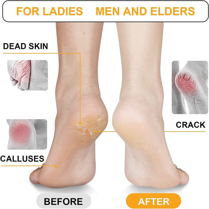 Zeeva Chrome Plated Glass Foot File, Foot Care Pedicure Tool, Hard Skin Cuticle Remover Scrubber, Great for Dead Skin Removal, Cracking, Used on Both Wet and Dry Feet Health & Beauty > Personal Care > Foot Care Zeeva   