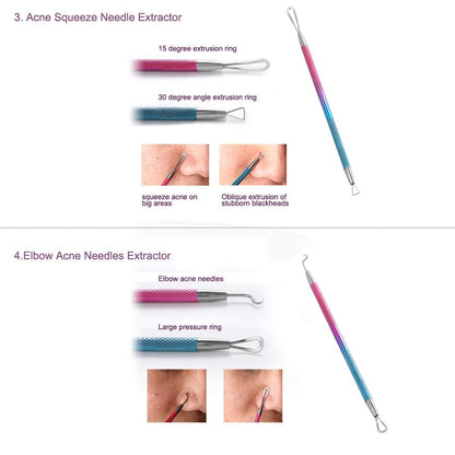 ZIZZON Blackhead Remover Kit Pimple Comedone Extractor Tool Set Treatment for Blemish, Zit, Acne Whitehead Tweezers Kit with 10X Magnifying Mirror Health & Beauty > Personal Care > Cosmetics > Cosmetic Tools > Skin Care Tools ZIZZON   
